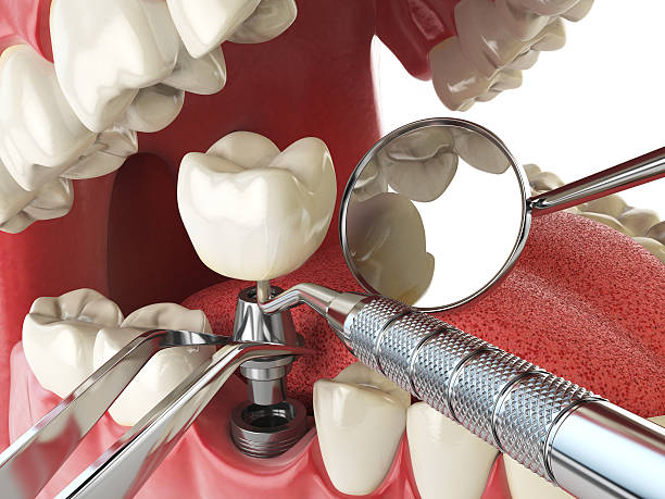 Best Broken Tooth Emergency  in Wellsville, KS